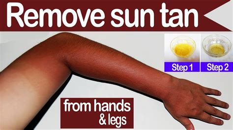 remove sun tan from hands